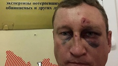Оренбуржец утверждает, что в аэропорту «Кольцово» его избили полицейские