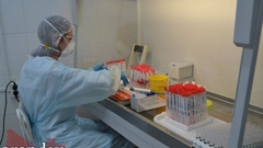 Минздрав скрывает, сколько в Оренбуржье проживает людей с ВИЧ-инфекцией